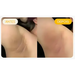 Adeus Dark Spot Correcting Cream for smooth and even-toned underarm skin - Buy now at MKPBR.COM - Worldwide Shipping