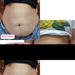 Adeus Multi-Action Intensive Body Cream for Cellulite and Stretch Marks – 10.58 oz (300g). Before and after comparison showing smoother, firmer skin results with visible cellulite reduction – Buy now at MKPBR.COM – Worldwide Shipping