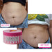 Adeus Multi-Action Intensive Body Cream for Cellulite and Stretch Marks – 10.58 oz (300g). Before and after comparison showing smoother, firmer skin results with visible cellulite reduction – Buy now at MKPBR.COM – Worldwide Shipping
