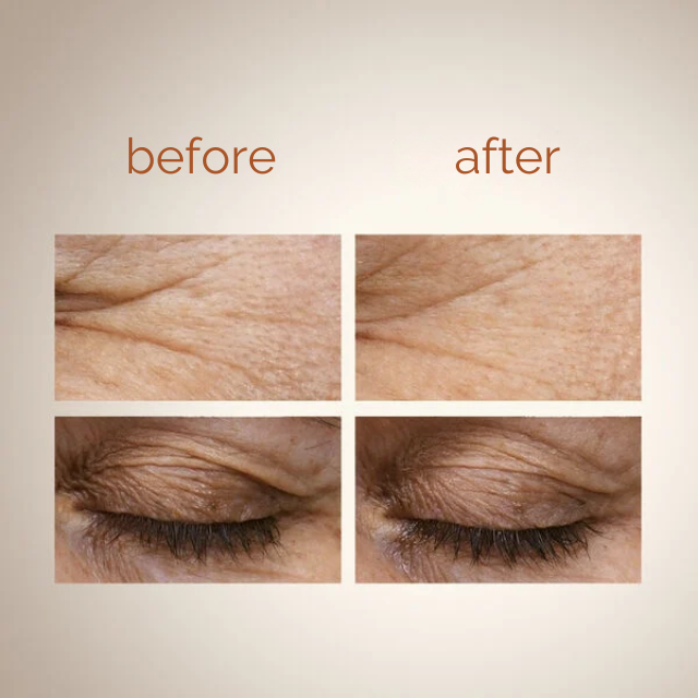 Natura Chronos Super Eye Serum softening wrinkle appearance and smoothing eye contour – Buy now at MKPBR.COM – Worldwide Shipping