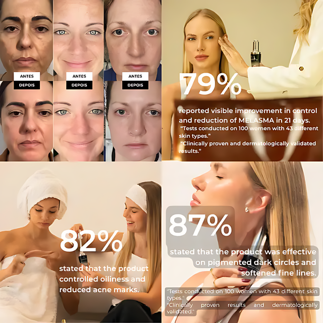 Saviora Anti-Aging Brightening Complex for Melasma & Dark Spots | Buy at MKPBR.COM – Worldwide Shipping