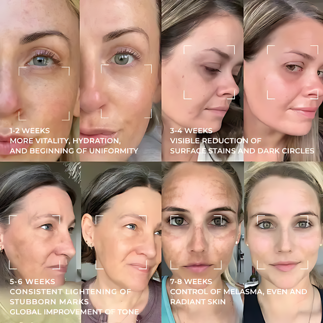 Saviora Skincare for Pigmentation Treatment – Visage D'Or Dark Spot Serum | Buy at MKPBR.COM – Worldwide Shipping