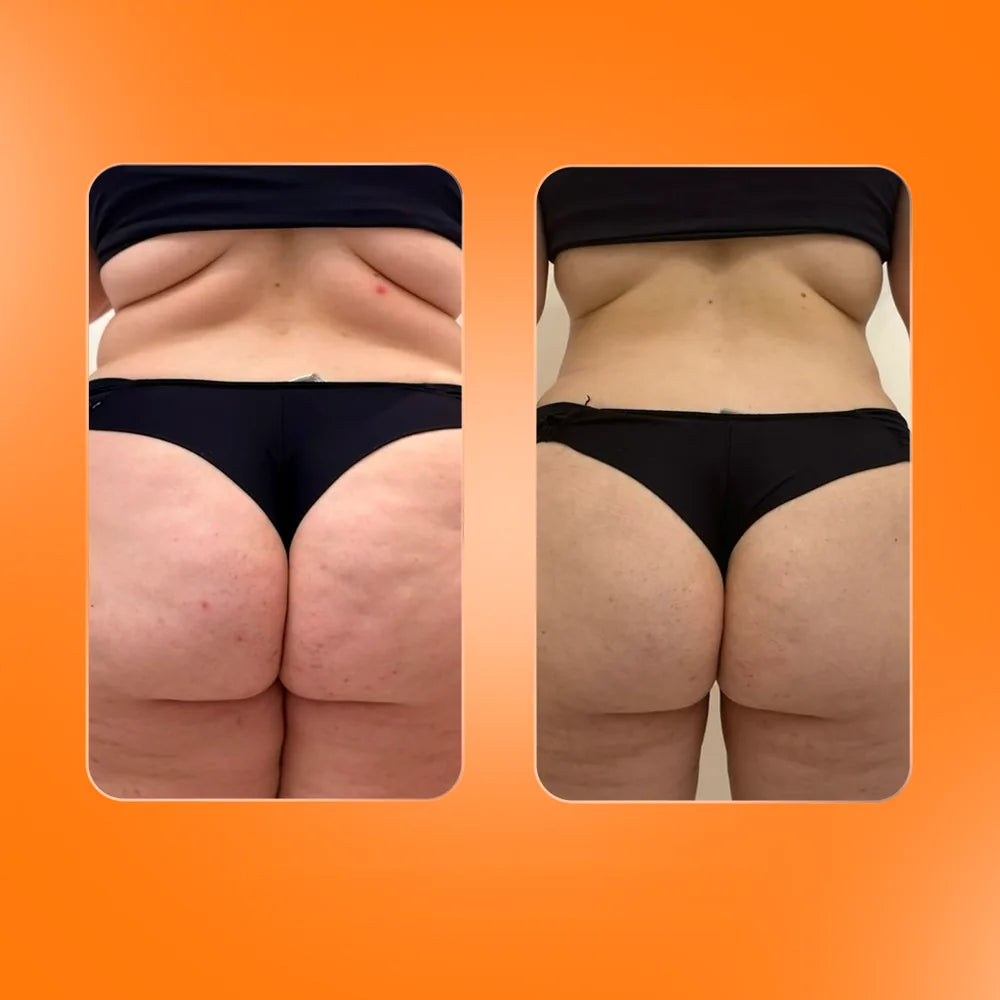 Reference photographs from the Peach Up perception study — BoomBoom Up