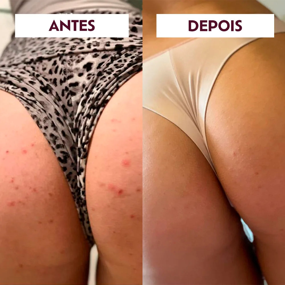 Reference photographs from the Peach Up perception study — Sugar Up